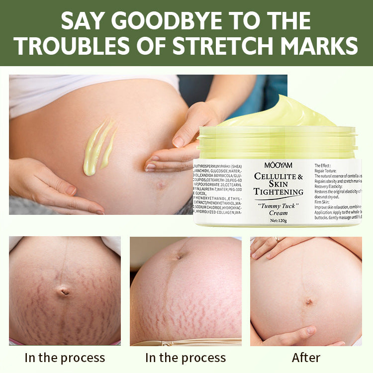 Cellulite &amp; Skin Tightening Cream (Tummy Tuck Cream).