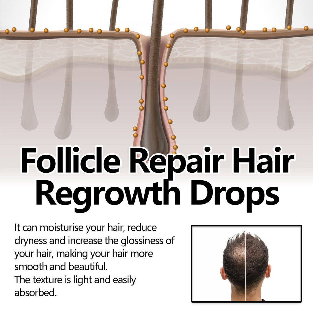 Crown Revival Elixir™ Follicle Support &amp; Density-Enhancing Hair Serum | Thick Hair Anti-fall Strong Hair Fixing Serums