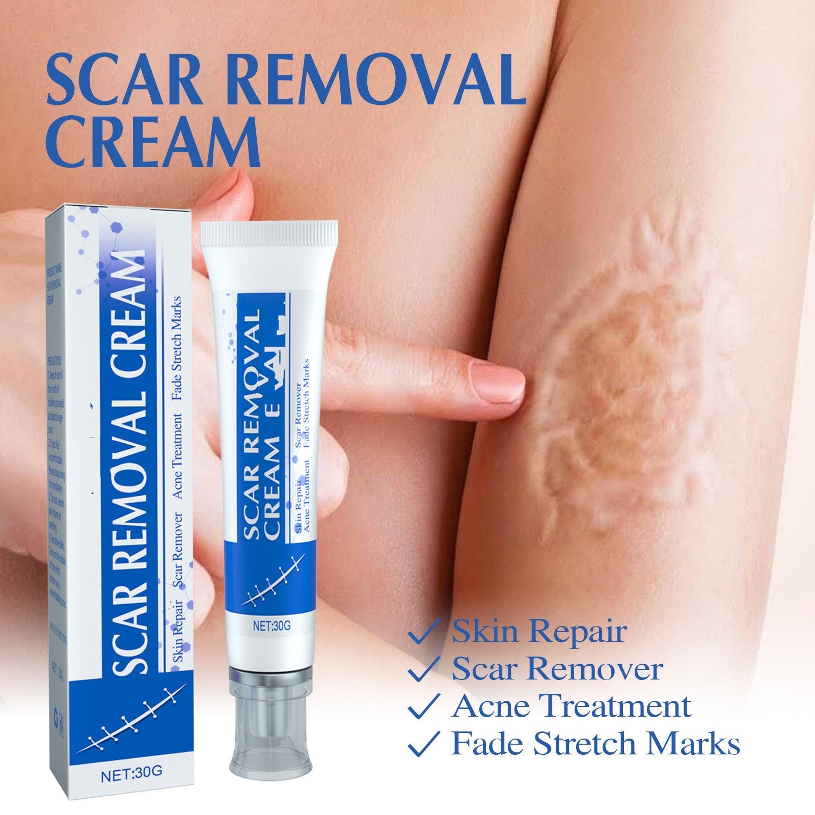 Scar Removal Cream (30g) — positioned for scar appearance improvement and skin smoothing.Scar To Lighten Surgical, Trauma Smooth And Tighten Skin Repair Cream