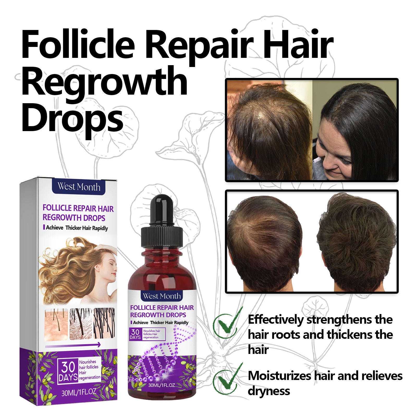 Crown Revival Elixir™ Follicle Support &amp; Density-Enhancing Hair Serum | Thick Hair Anti-fall Strong Hair Fixing Serums