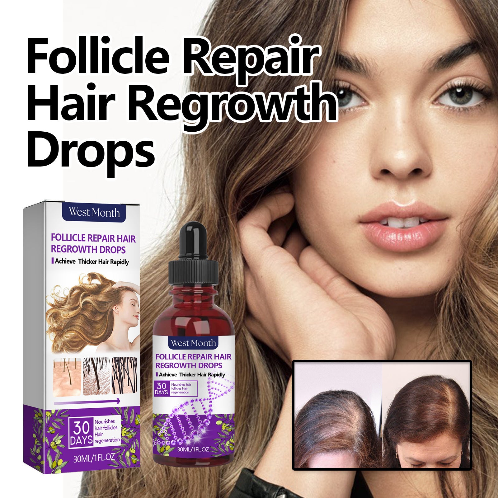 Crown Revival Elixir™ Follicle Support &amp; Density-Enhancing Hair Serum | Thick Hair Anti-fall Strong Hair Fixing Serums