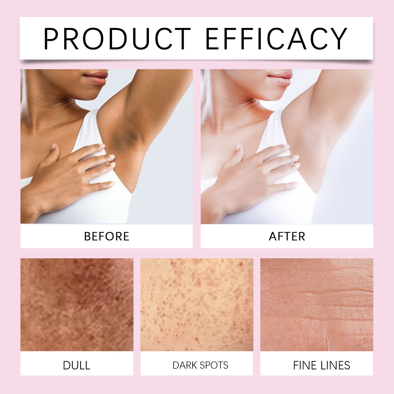 Intimate Area Brightening Gel – Multi-Actives 10% Brightening Concentrate - Body Black Spot Correction Cream Whitening Skin