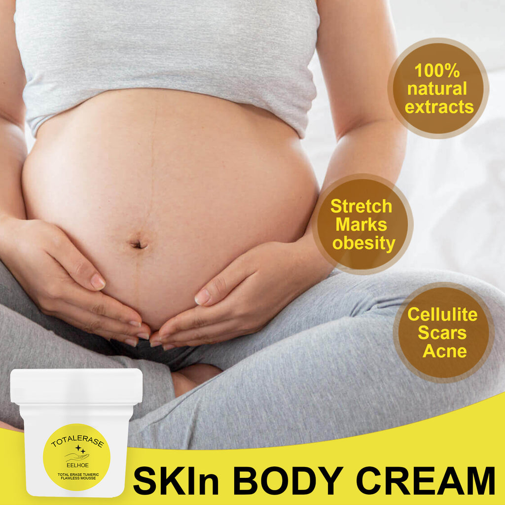 Total Erase Turmeric Flawless Mousse / Skin Body Cream (stretch mark + cellulite focused body cream).Fade Prevention Of Obesity Pregnancy Repair Cream