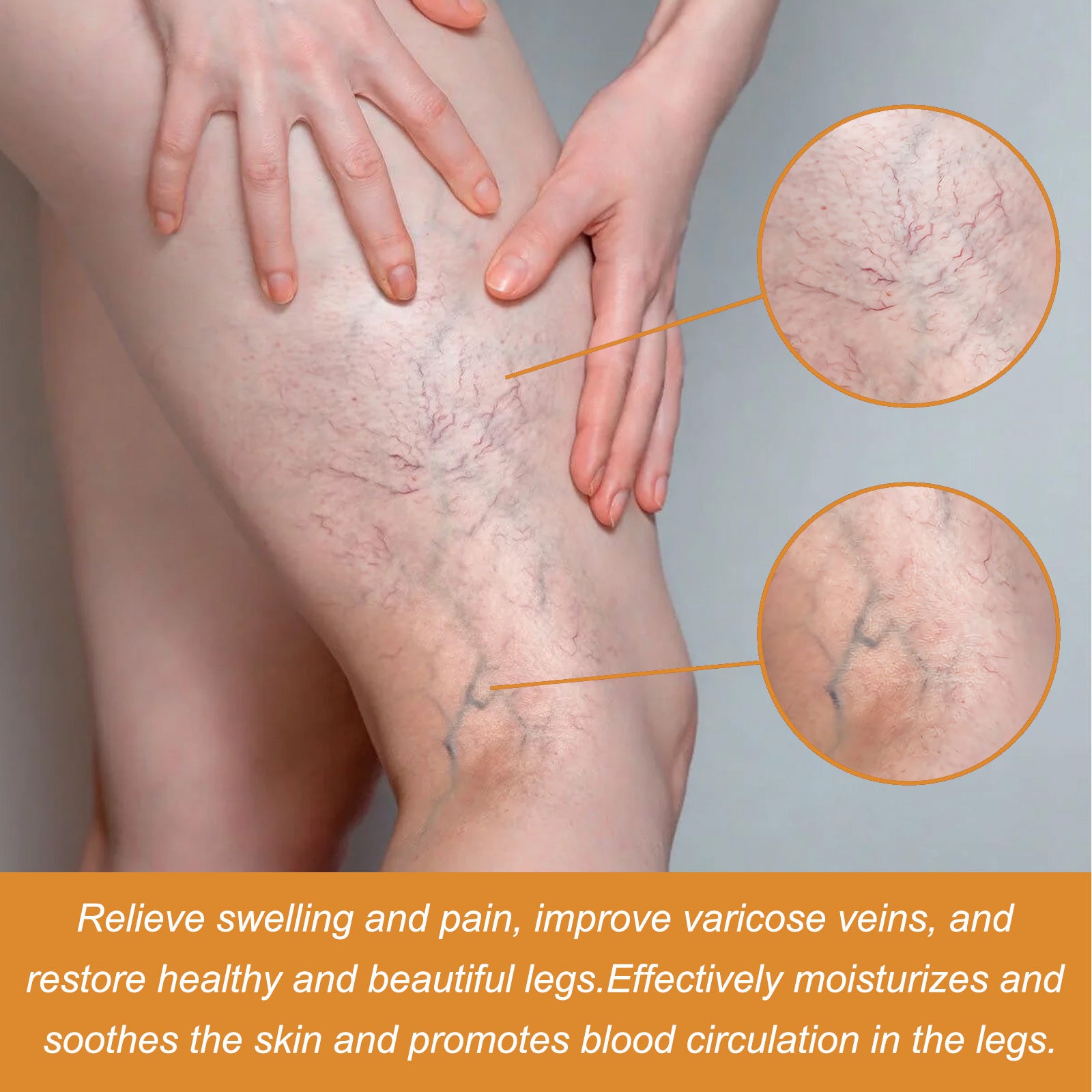 Varicose Veins Health Care Cream / Serum Set (topical leg treatment). Relieve Soreness and Swelling, Flexure, Earthworm Legs, Green Bands, Bulge Repair