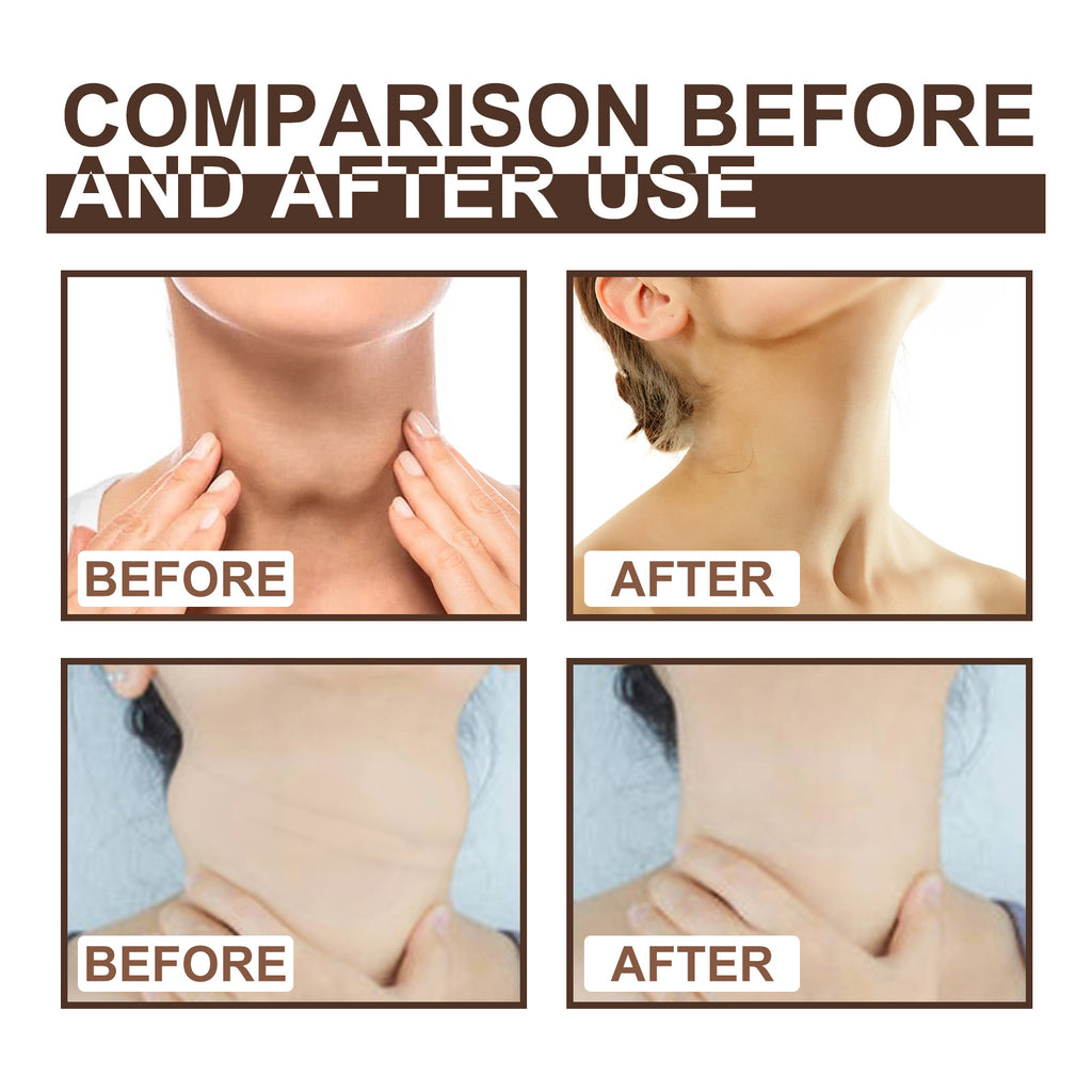 Thyroid Gland Care Ointment. Lymph Repair Cream Relieves Body Health Care