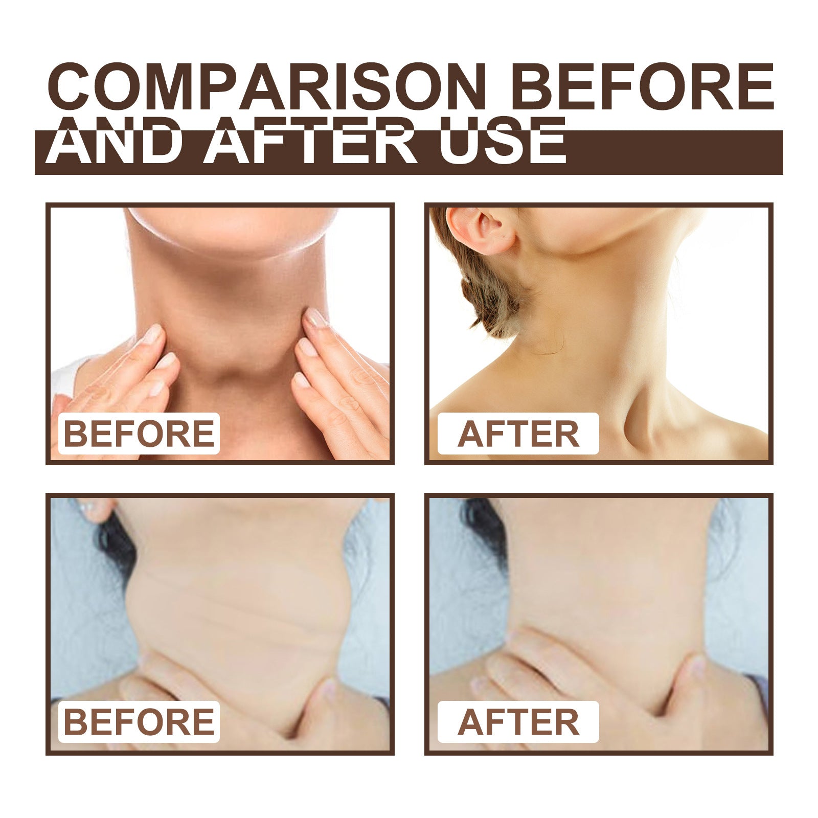 Thyroid Gland Care Ointment. Lymph Repair Cream Relieves Body Health Care