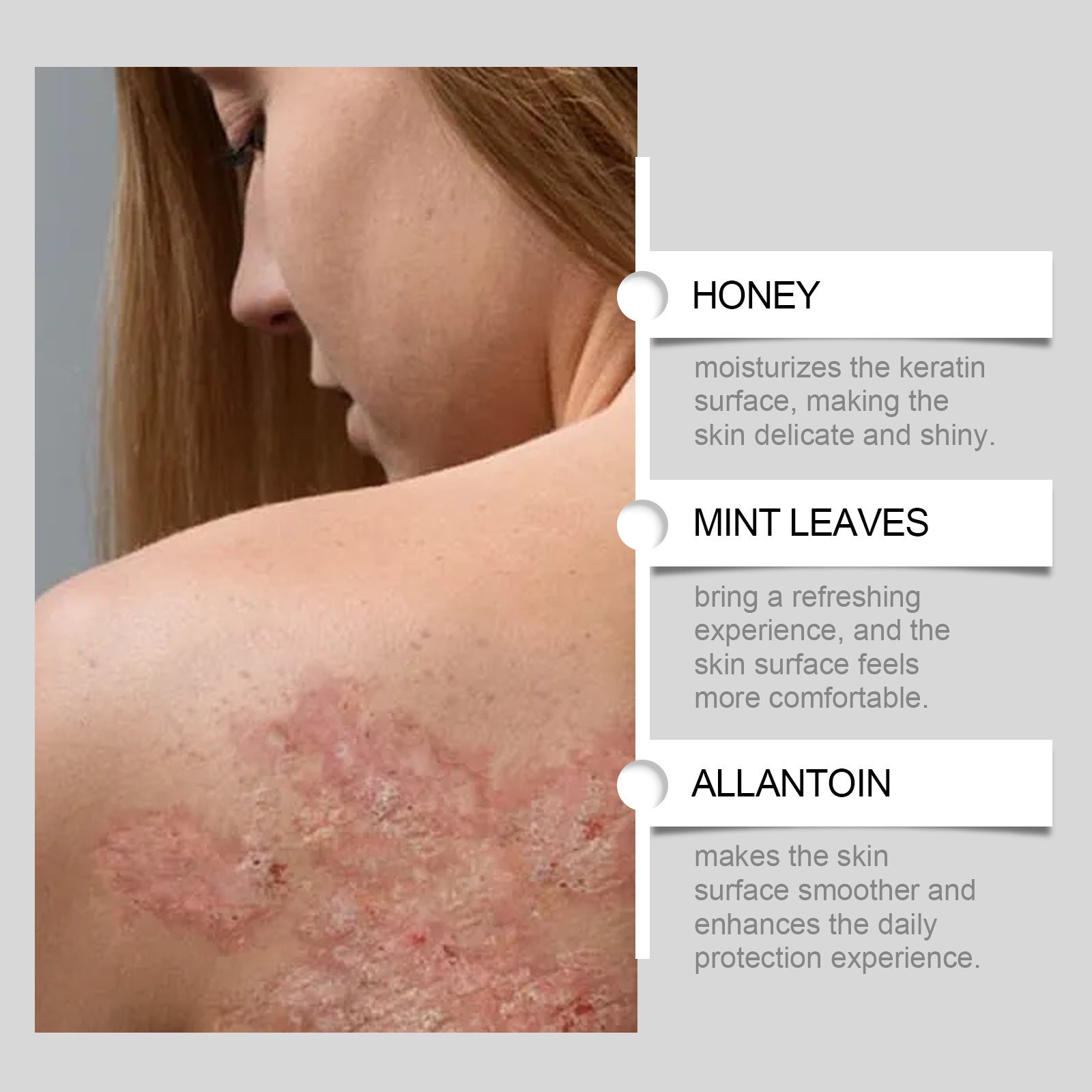 Manuka Honey Skin Cream (soothing + repair-focused body cream). Eczema Repair Cream