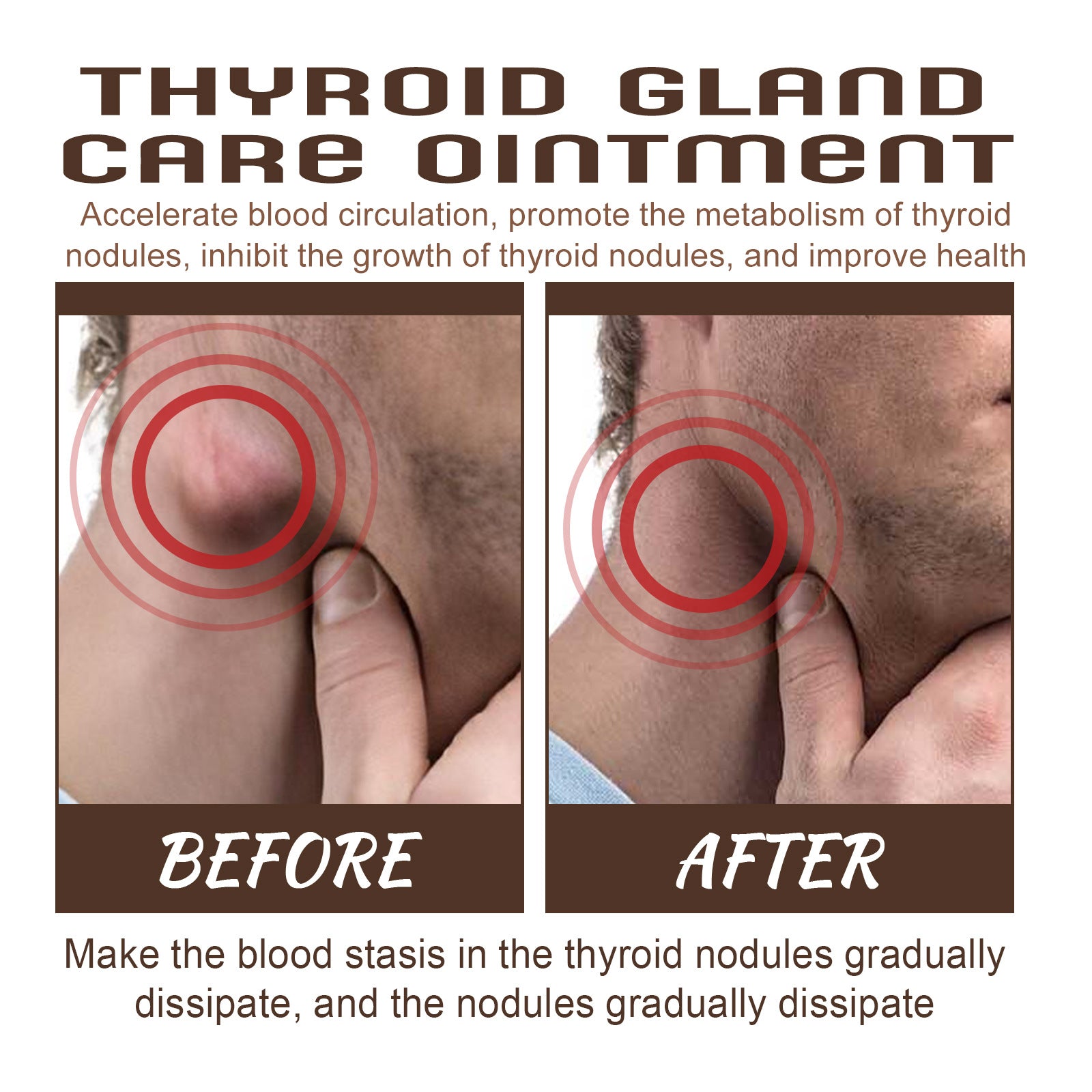 Thyroid Gland Care Ointment. Lymph Repair Cream Relieves Body Health Care