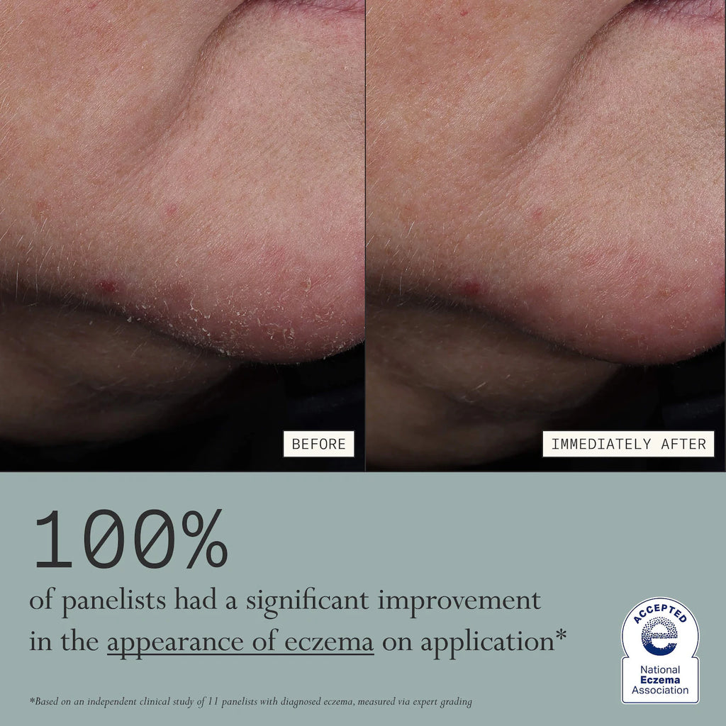 Dieux Skin Mercy Intense Recovery Cream – 1% Colloidal Oatmeal for Sensitive & Eczema‑Prone Skin