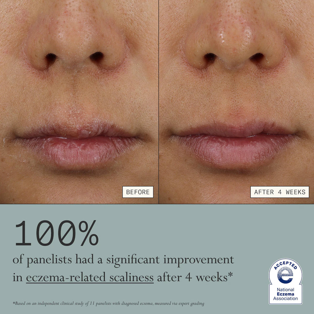 Dieux Skin Mercy Intense Recovery Cream – 1% Colloidal Oatmeal for Sensitive & Eczema‑Prone Skin