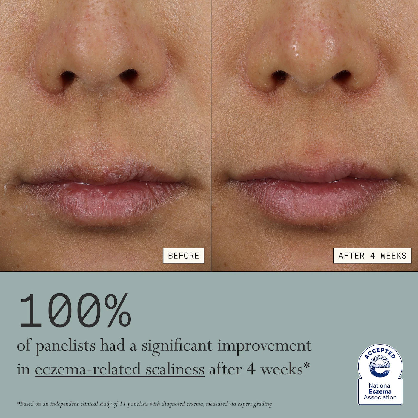Dieux Skin Mercy Intense Recovery Cream – 1% Colloidal Oatmeal for Sensitive & Eczema‑Prone Skin