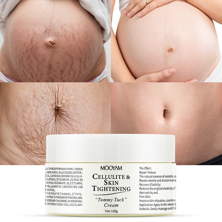 Cellulite &amp; Skin Tightening Cream (Tummy Tuck Cream).