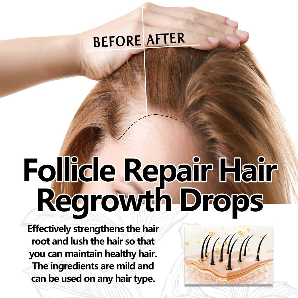 Crown Revival Elixir™ Follicle Support &amp; Density-Enhancing Hair Serum | Thick Hair Anti-fall Strong Hair Fixing Serums
