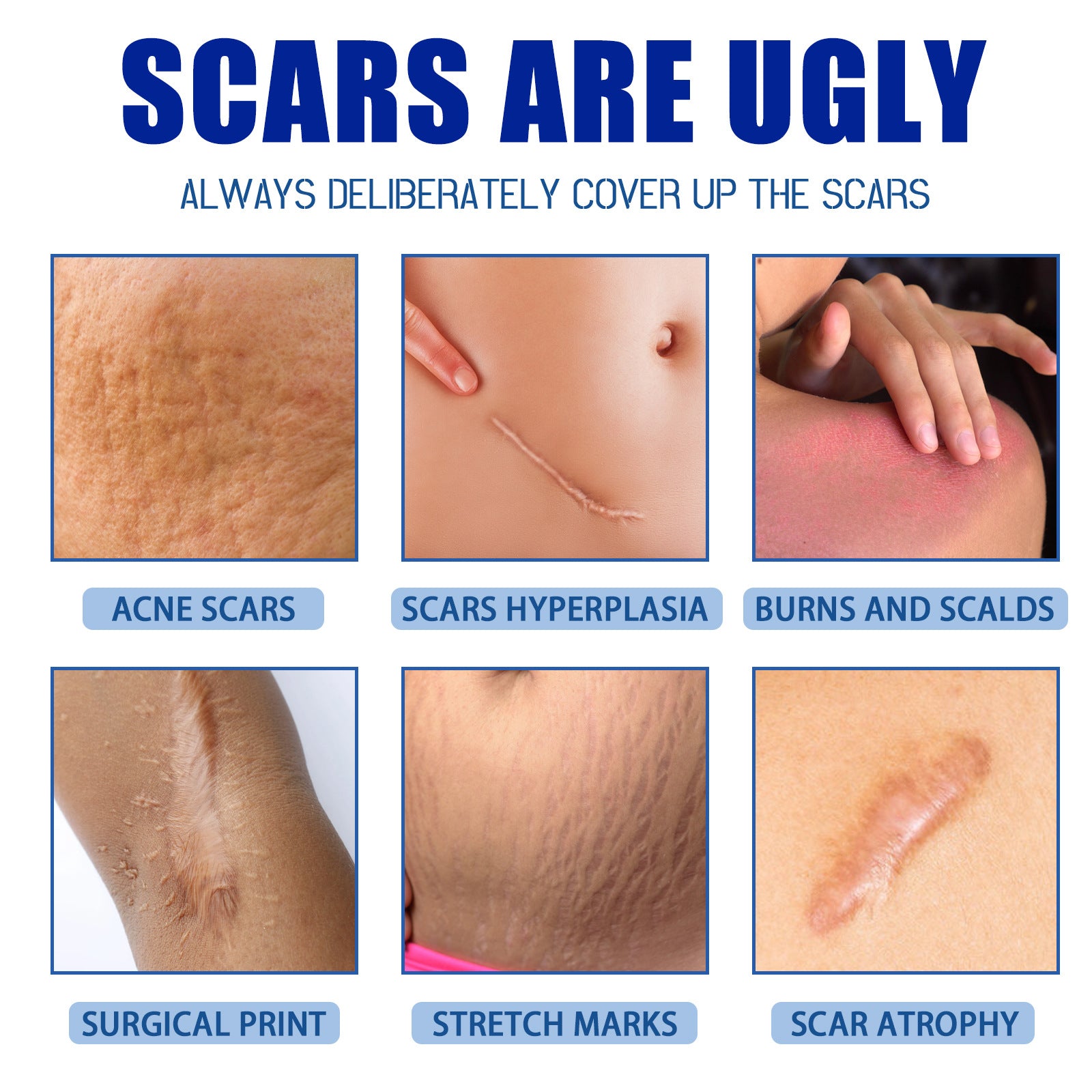 Scar Removal Cream (30g) — positioned for scar appearance improvement and skin smoothing.Scar To Lighten Surgical, Trauma Smooth And Tighten Skin Repair Cream