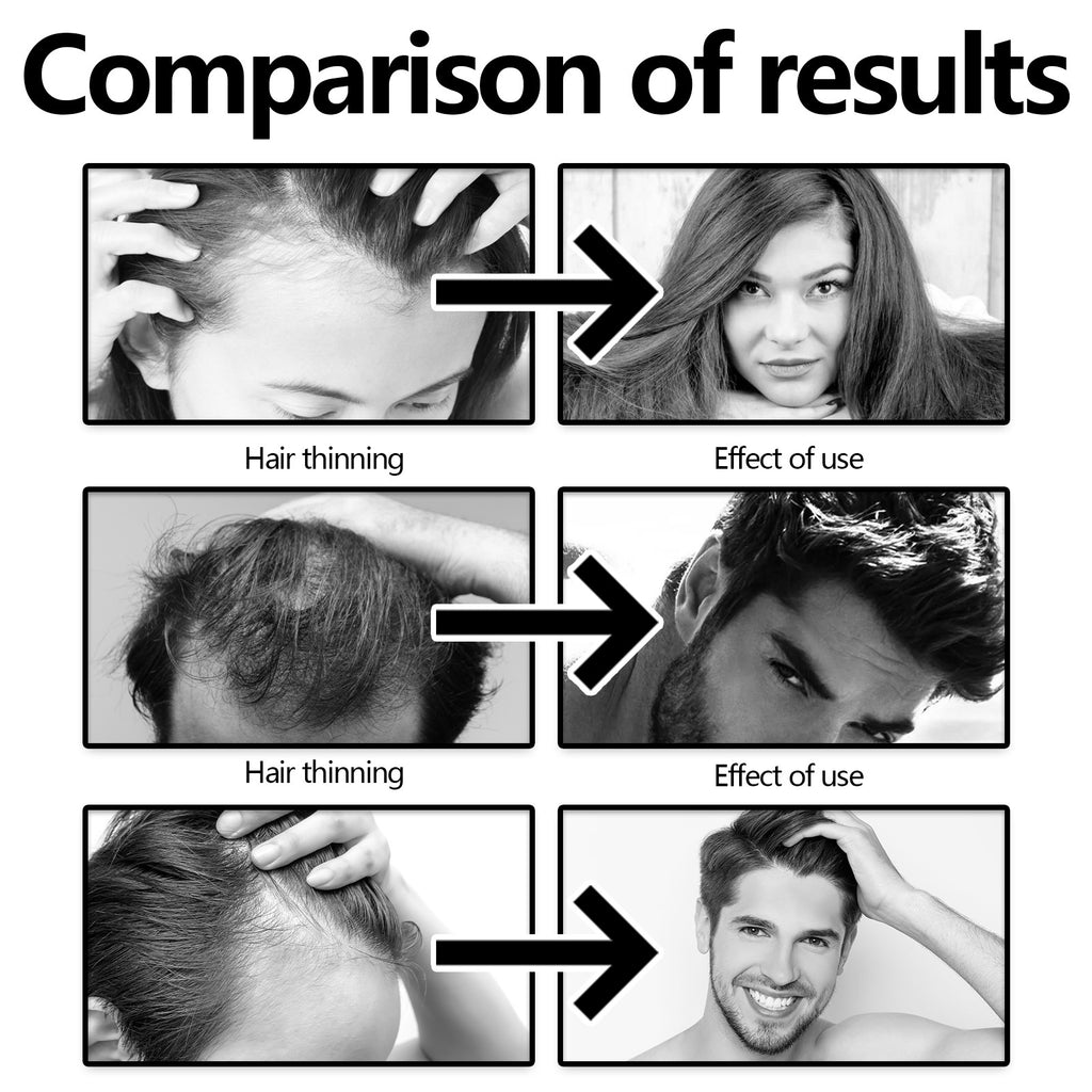 Crown Revival Elixir™ Follicle Support &amp; Density-Enhancing Hair Serum | Thick Hair Anti-fall Strong Hair Fixing Serums