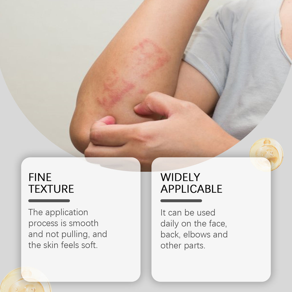 Manuka Honey Skin Cream (soothing + repair-focused body cream). Eczema Repair Cream